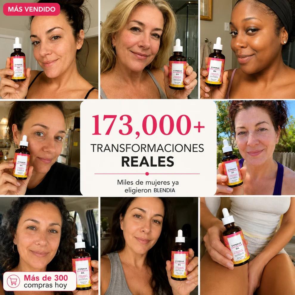 Aceite Cyperus - Adiós Depilación Constante