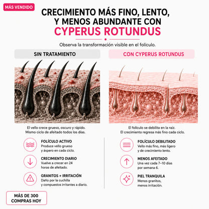 Aceite Cyperus - Adiós Depilación Constante