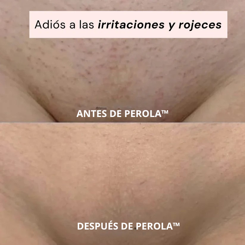 Perola™ La única depiladora que necesitaras
