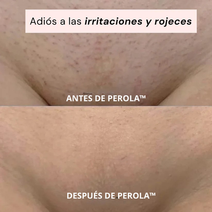Perola™ La única depiladora que necesitaras