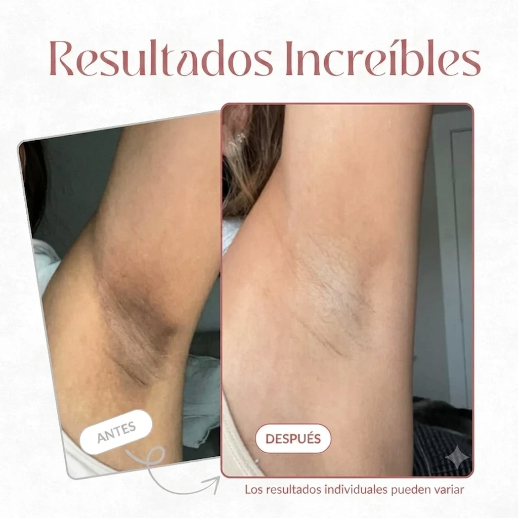 Spray Corporal Blanqueador
