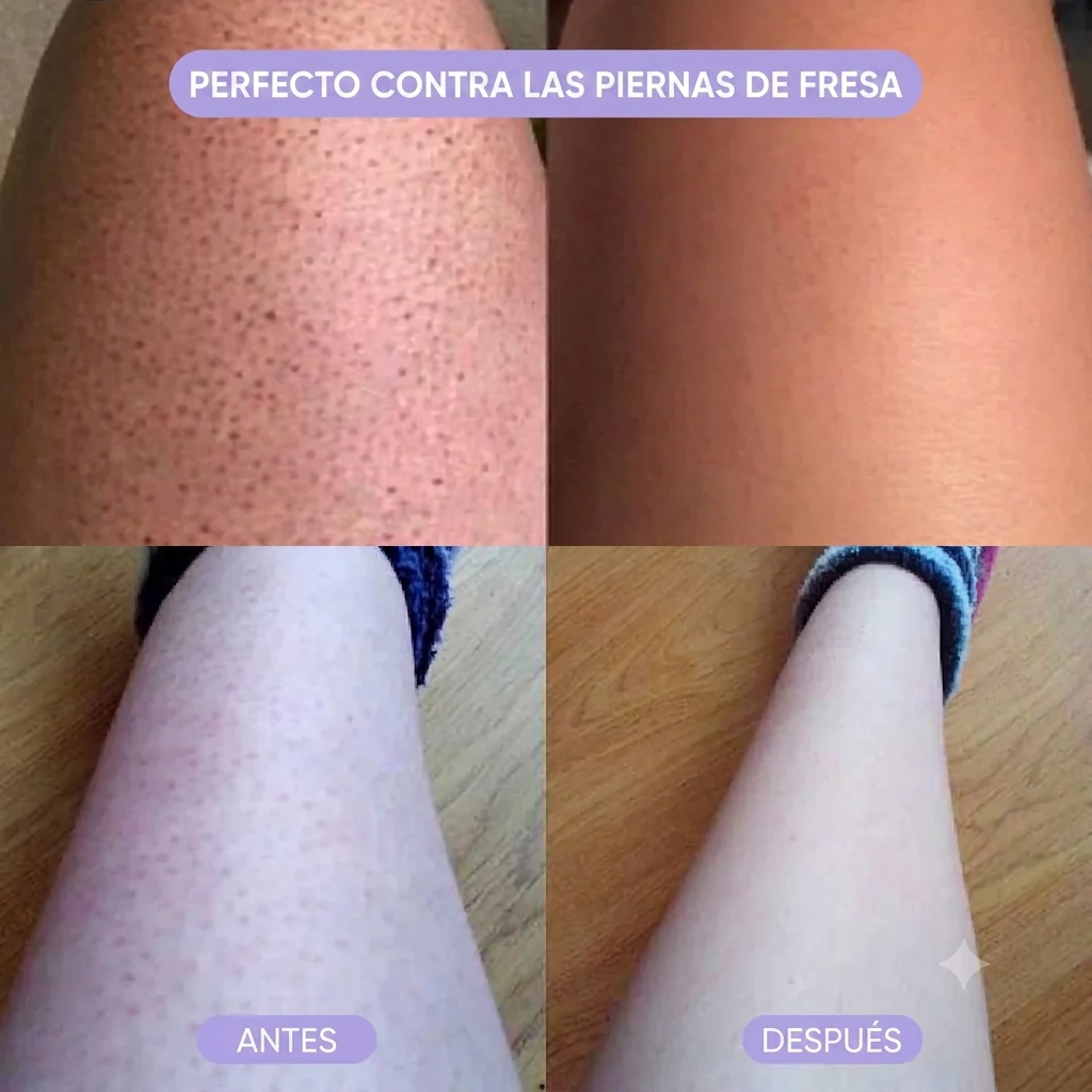 Mousse Depilatorio Indoloro