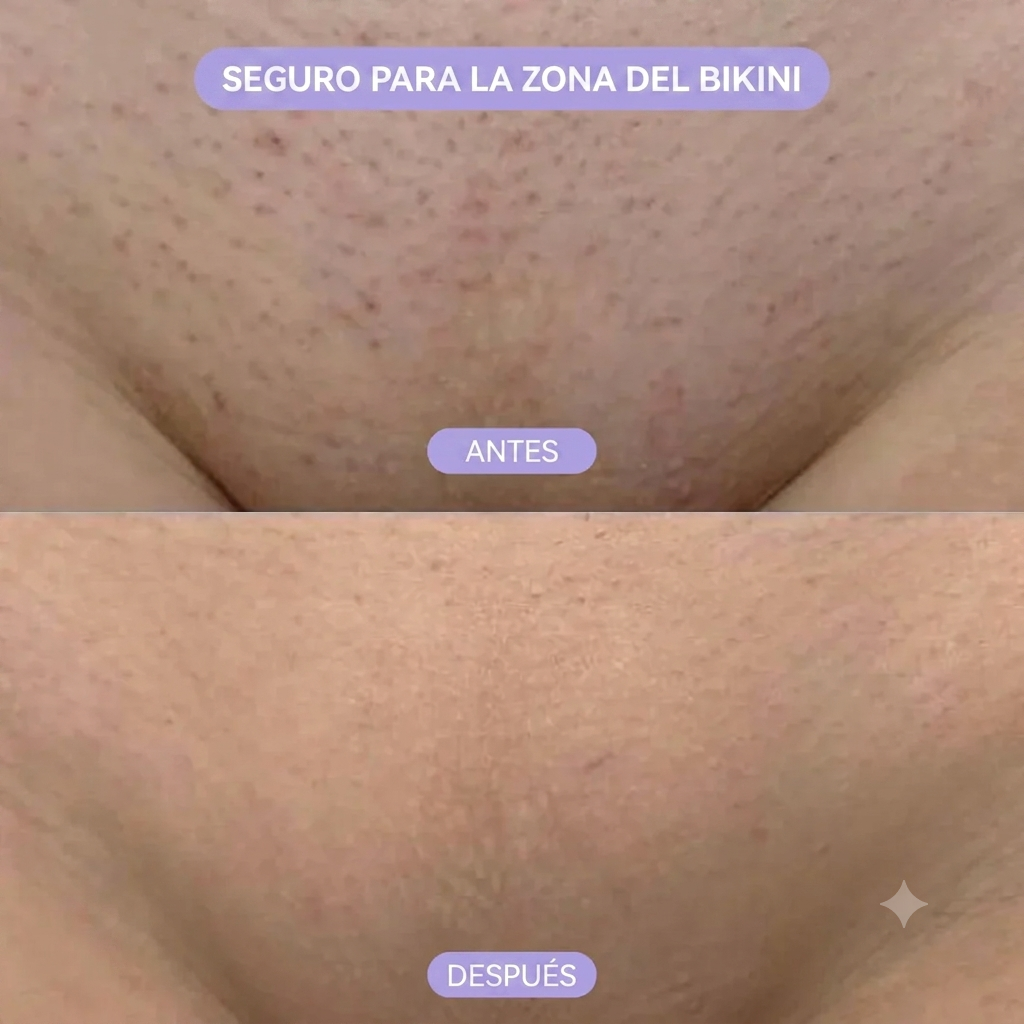 Mousse Depilatorio Indoloro