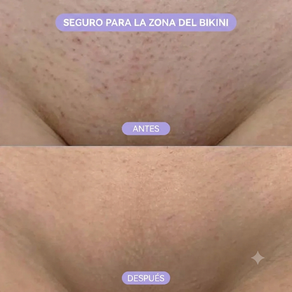 Mousse Depilatorio Indoloro